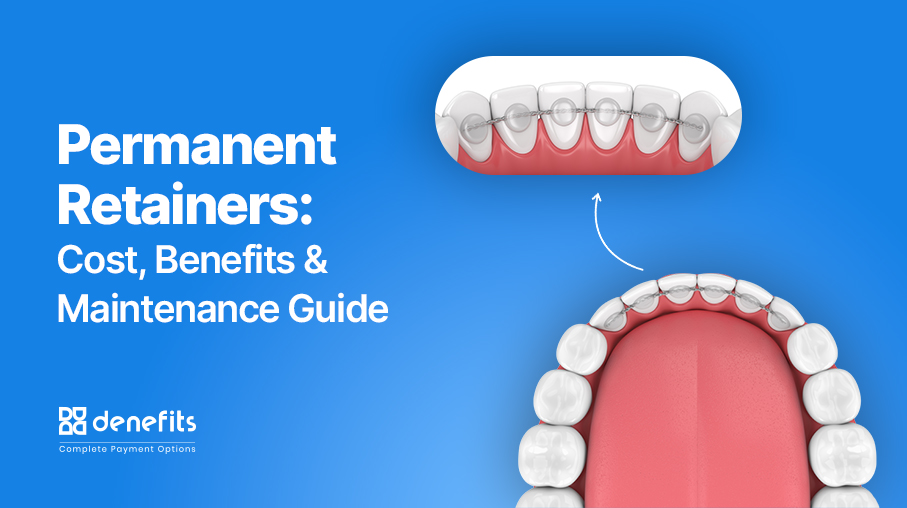 Permanent retainers